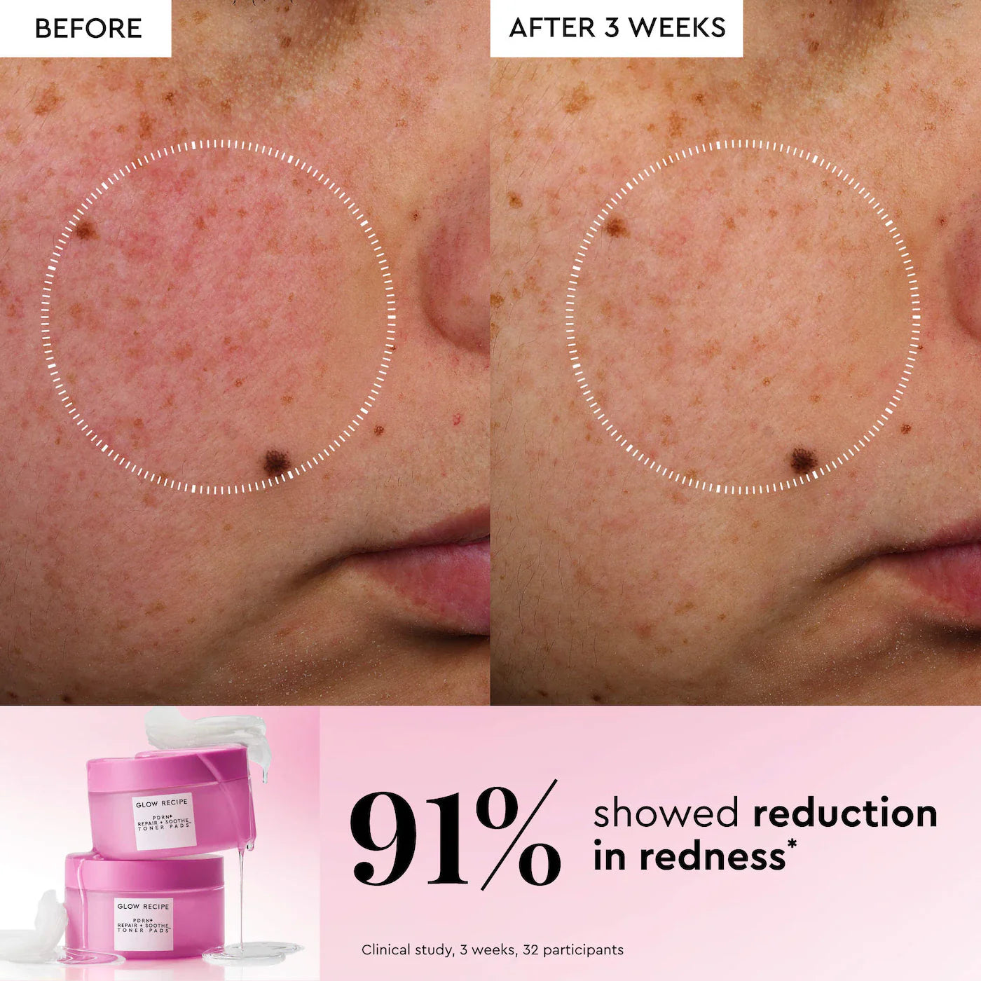 PDRN Repair + Soothe Korean Prickly Pear Toner Pads for Skin Barrier Repair