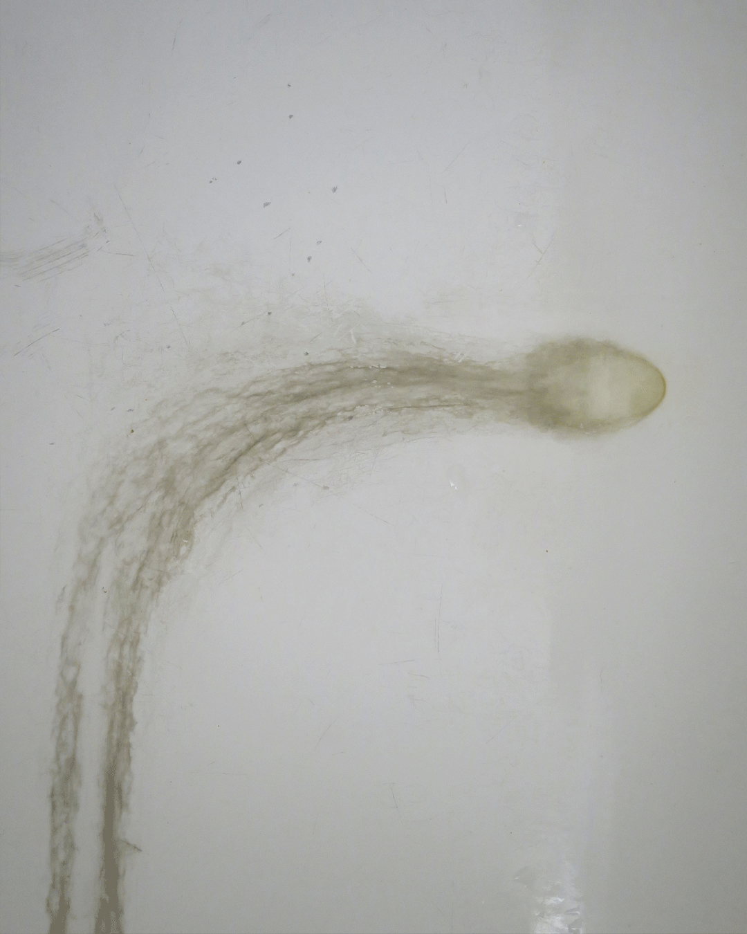 SEMINALIS